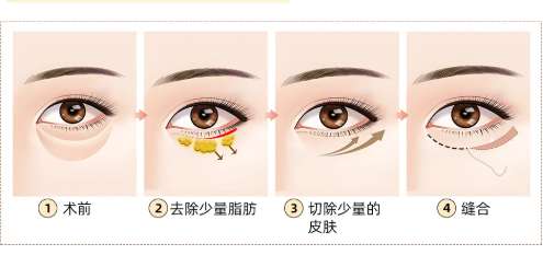 QQ20250411-173121.jpg