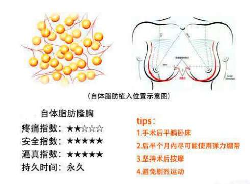 劉成勝脂肪豐胸是脂肪膠嗎？脂肪膠是神奇魔法嗎?