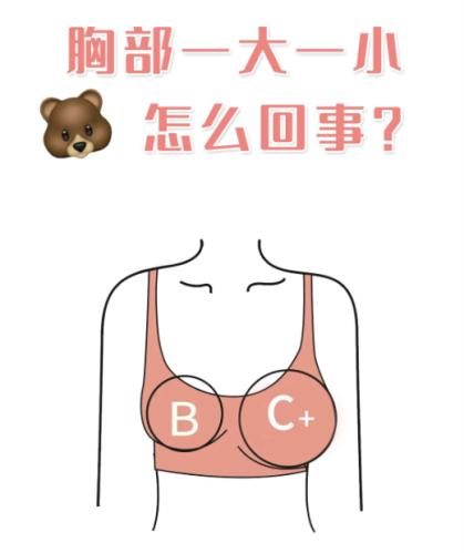 胸部一大一小怎么辦？超實(shí)用解決指南來(lái)啦