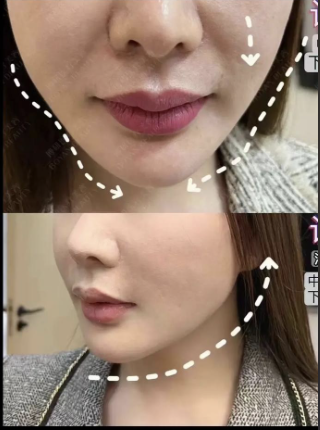 穆寶安醫(yī)生面部提升預約掛號全攻略：輕松掛上 “逆齡號”