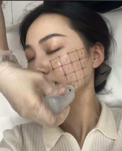 熱瑪吉做一次能維持多久？效果續(xù)航大揭秘