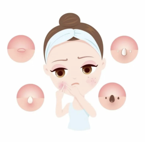 深圳看痘痘去哪個(gè)醫(yī)院比較好？祛痘醫(yī)院紅榜大公開(kāi)