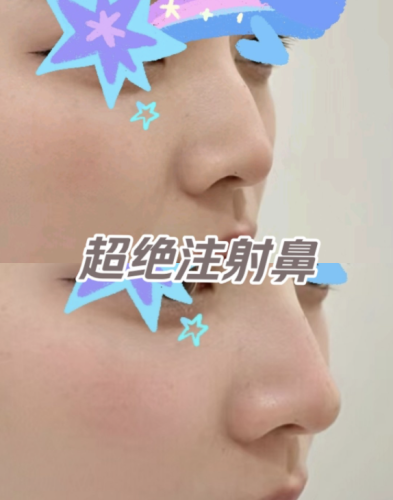濡白天使和寶尼達(dá)哪個(gè)適合打鼻子？ “夢(mèng)中情針”究竟花落誰(shuí)家？