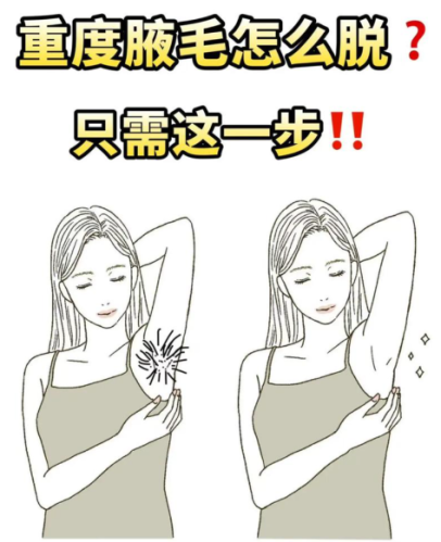 腋毛怎么去除？清爽腋下的 “美麗錦囊”