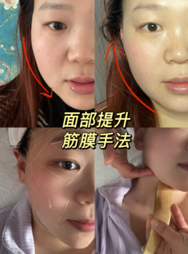 北京筋膜提升在哪個醫(yī)院好一點呢？解鎖新的逆齡密碼