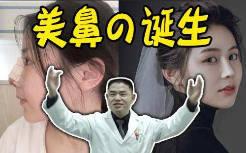 李保鍇鼻子做得怎么樣？雕琢自然之美