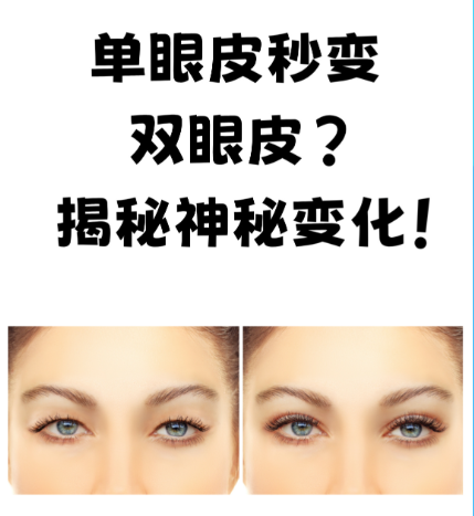單眼皮做成雙眼皮要多少錢？ “變美賬單”背后的秘密大公開