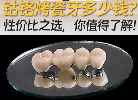 鈷鉻烤瓷牙齒的優(yōu)缺點(diǎn)分析，算得上性價(jià)比之王