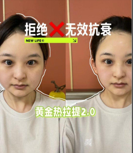 黃金熱拉提多少錢一次？錢包要 “瘦身” 多少？