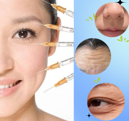 透明質(zhì)酸除皺用什么產(chǎn)品？選品指南來(lái)教你