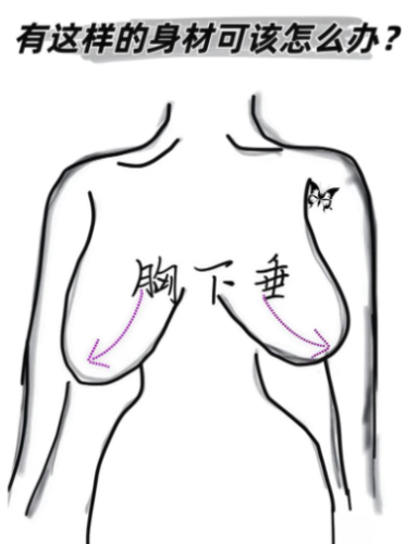 胸為什么會(huì)下垂？就像蘋果熟了會(huì)掉，這里面藏著這些門道