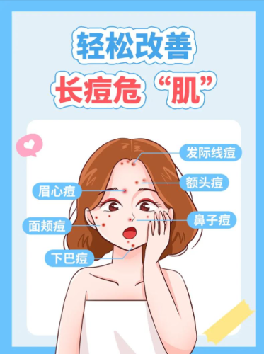 深圳痘痘治療哪家醫(yī)院好？這三家醫(yī)院各的絕活你肯定不知道