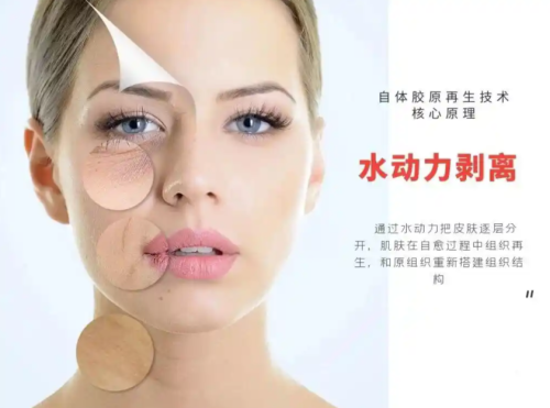 水剝離祛眼袋能維持多久？結(jié)合具體案例和對(duì)比表，詳細(xì)說說