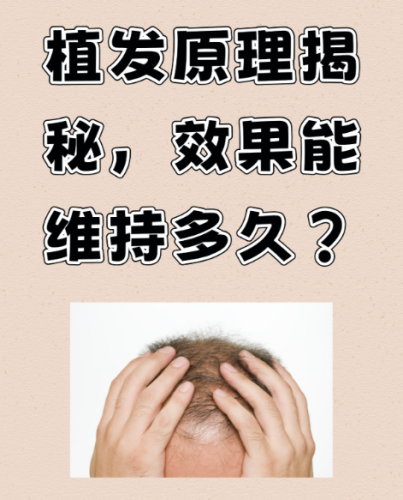 頭發(fā)種植原理：給禿發(fā)區(qū) “移栽” 健康毛囊