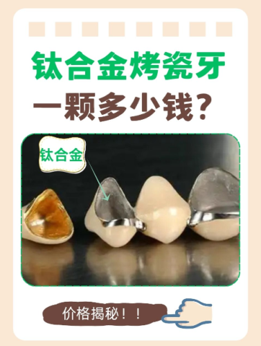 鈦合金烤瓷牙多少錢？不同牙齒情況有不同賬本