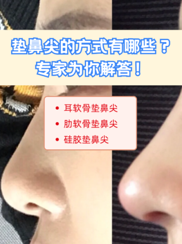 如何墊鼻梁比較融合？讓新鼻梁像 “天生長出來” 的