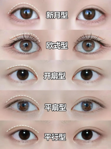 雙眼皮有幾種款式？這么多隱藏款你知道嗎