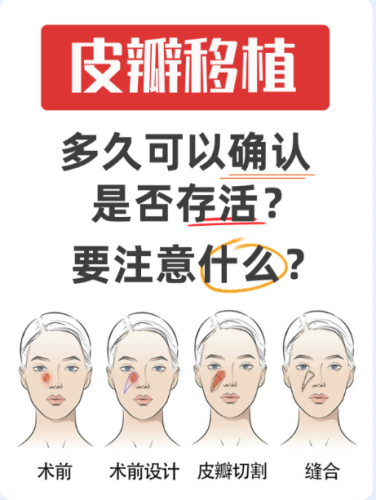 微粒皮移植最佳供皮區(qū)?：從臨床實(shí)踐看部位選擇