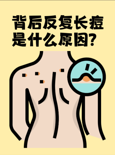 背上長(zhǎng)痘痘什么原因?qū)е碌模繌钠つw深處找答案