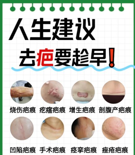 如何去疤痕？從類型到方法的針對性方案