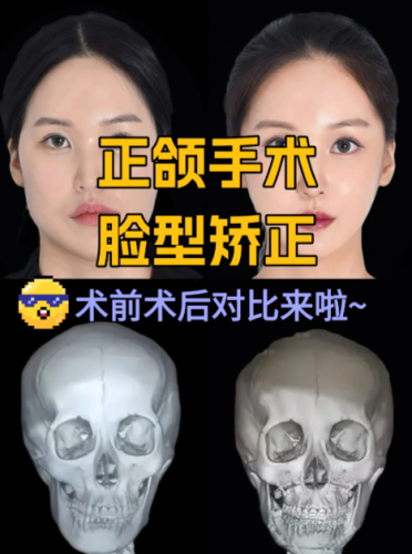 廣大醫(yī)院做正頜手術(shù)做的怎么樣？有興趣的朋友趕緊來(lái)看看
