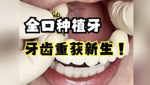 北京哪家口腔醫(yī)院種植牙比較好？這幾家給我沖！