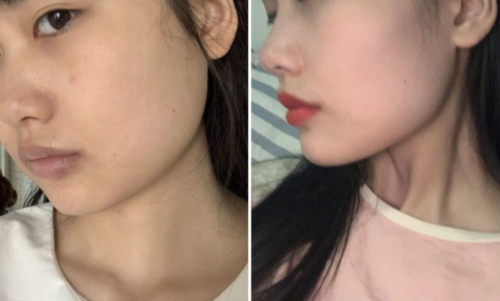 重慶安可忍磨骨好不好？從專業(yè)維度全面評估