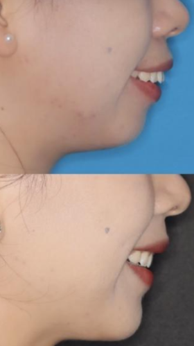 北京哪家口腔醫(yī)院矯正牙齒比較好？來(lái)看看矯正界的 “妙手仁心”