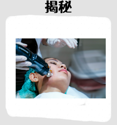 廣州曙光醫(yī)院祛斑要多少錢？看完直接拿捏預算