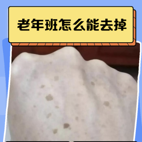 老年斑能治嗎？容易去掉嗎？