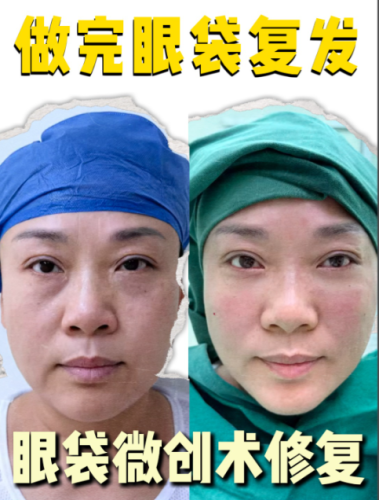 北京哪里做眼袋修復(fù)好？不同醫(yī)院的修復(fù)優(yōu)勢一一呈現(xiàn)