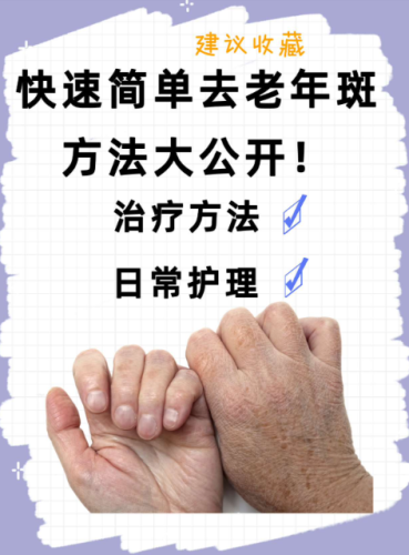 如何去除老年斑？實用方法與護(hù)理建議，趕緊收藏