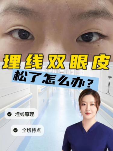 上海張?jiān)娙綦p眼皮修復(fù)多少錢？影響價(jià)格在這些方面