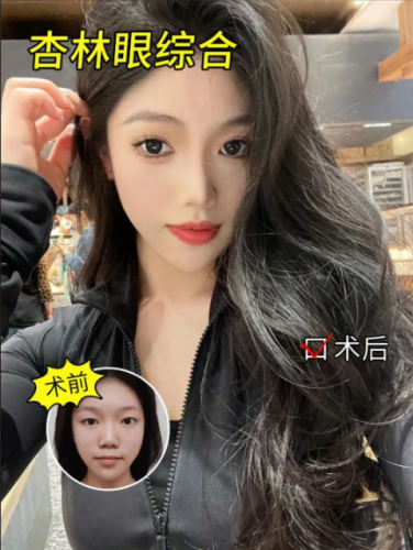 沈陽(yáng)杏林哪個(gè)醫(yī)生做眼部好？從實(shí)際需求選對(duì)人