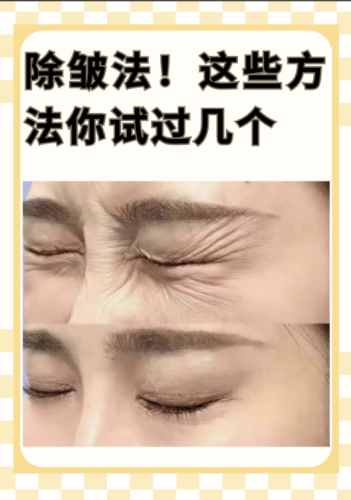 杭州第一人民醫(yī)院除皺手術(shù)怎么樣？求真實體驗！