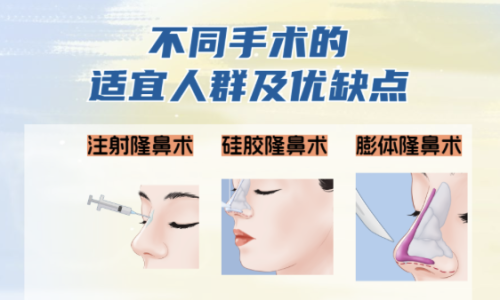 鼻整形的方式有哪些
