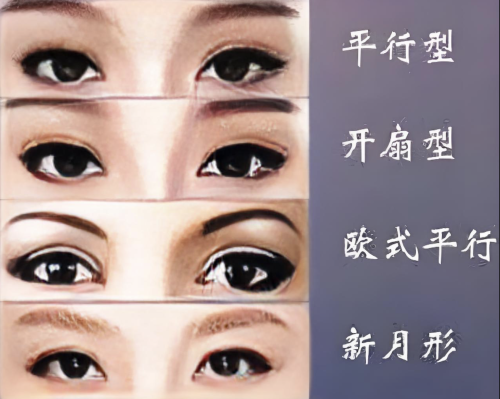 新疆維吾爾自治區(qū)中醫(yī)醫(yī)院割雙眼皮多少錢？手術(shù)直接穩(wěn)得一批