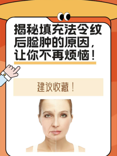 填法令紋會腫嗎？別慌，今天深扒腫脹原因和急救攻略！
