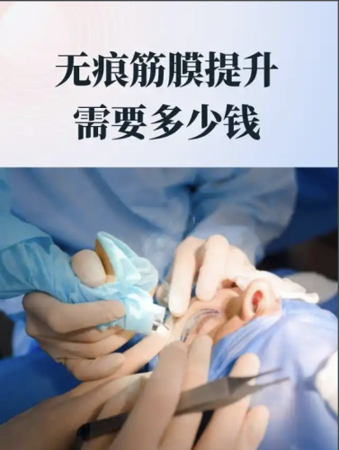 筋膜提升價格一般多少？ 手術(shù)方式：價格分層的基礎(chǔ)