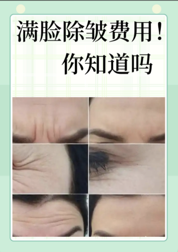 濱州第二人民醫(yī)院除皺手術(shù)怎么樣？主打的就是一個安心！