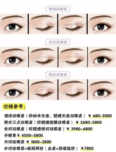 做雙眼皮的價格一般是多少？跟拆盲盒似的，全看好多因素“湊熱鬧”