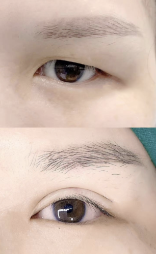 浙江省中醫(yī)院錢塘院區(qū)割雙眼皮多少錢？給大家列個(gè)表看看