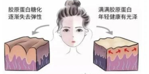 面部緊致的危害和副作用：稍有不慎就可能成為“美麗刑具”
