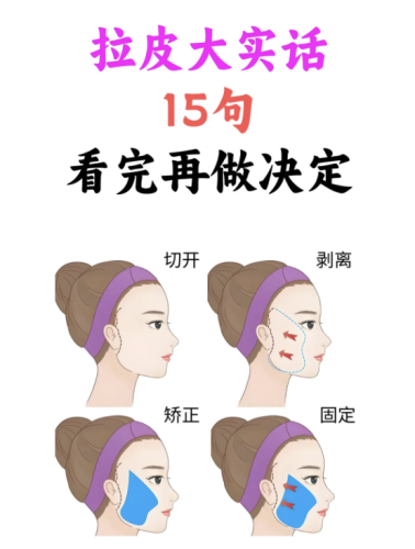 拉皮手術(shù)的副作用和危害：那些“見不得光”的風(fēng)險