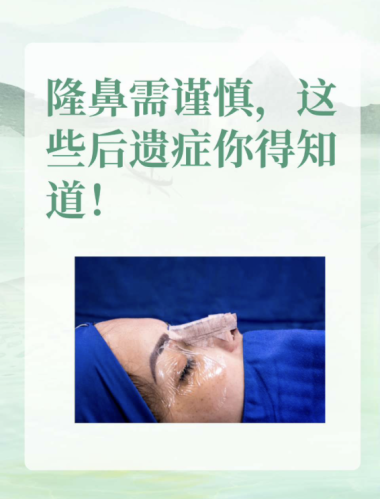做隆鼻有后遺癥嗎？來探討華麗變身背后的風(fēng)險