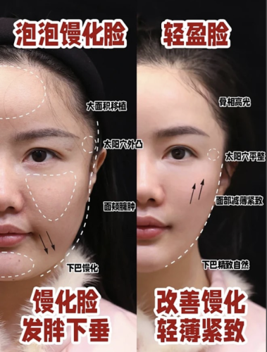 饅化修復是什么？檢測、溶解、緊致一條龍服務