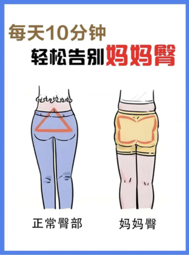 媽媽臀特別大怎么消除？有效方法全解析