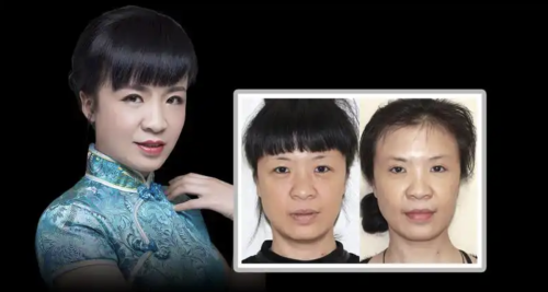 錦州中心醫(yī)院隆鼻怎么樣？多樣的技術(shù)合理的價(jià)格