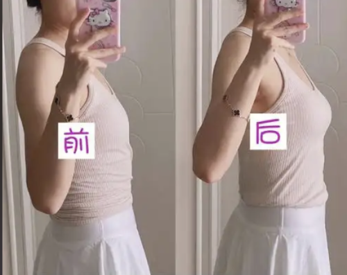 杭州第一人民醫(yī)院隆胸多少錢(qián)？扒一扒這家醫(yī)院隆胸的真實(shí)費(fèi)用