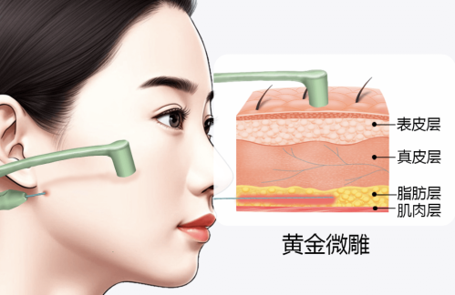 黃金微雕價(jià)格大概多少錢？放心，錢包不會(huì)瑟瑟發(fā)抖